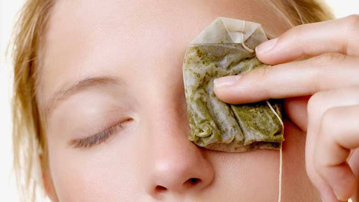 Las bolsistas de te para quitar las ojeras es uno de los remedios más usados.