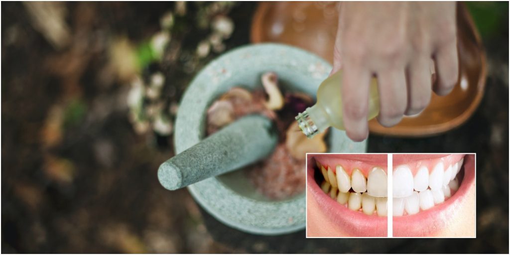 elimina la placa dental y el sarro con aceite de coco para absorber las impurezas