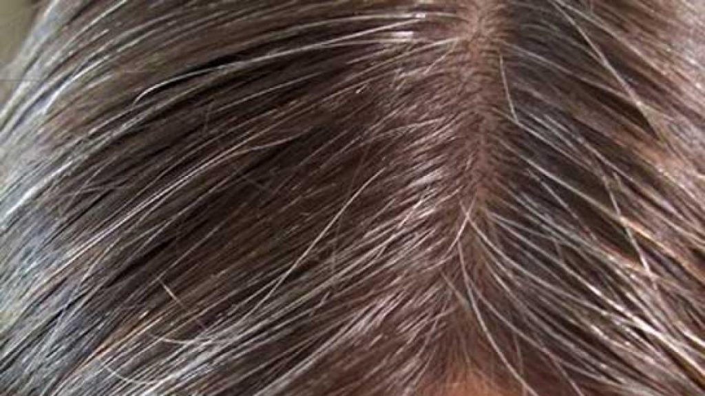 Los Remedios naturales para el cabello ayudan a eliminar la aparición de canas