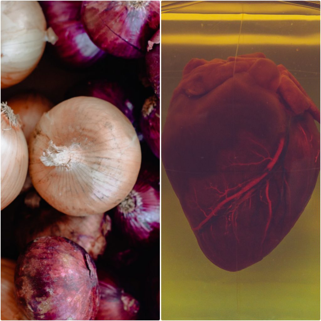Los Remedios caseros con cebolla para el corazón evitan los infartos del miocardio