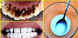 elimina-la-placa+dental-y-el-sarro-solo-con-esta-mezcla