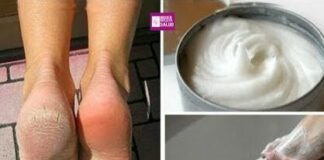 Elimina los hongos, las grietas y los callos de los pies con este remedio casero