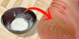 Elimina los talones agrietados y los pies ásperos con esta mascarilla