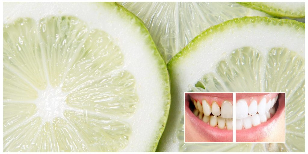 elimina la placa dental y el sarro con el limón y quita las bacterias de tus dientes