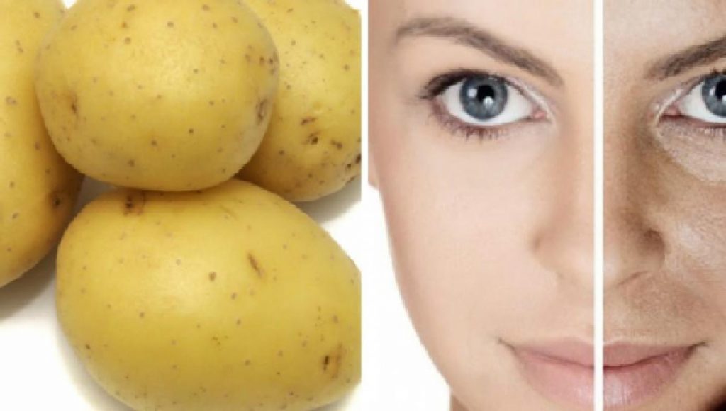Los antioxidantes la papa blanquea tu piel y elimina las manchas