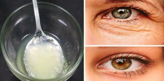 remedios caseros para eliminar las arrugas debajo de los ojos