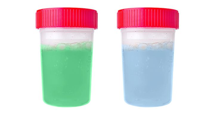 Dos frascos de orina con coloraciones azul y verde.