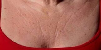 tonificar el cuello