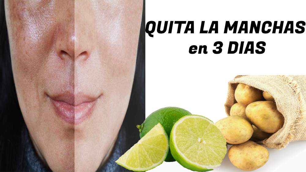 Elimina Las Manchas De Tu Cara En Solo 3 Noches Con Este Truco Salud