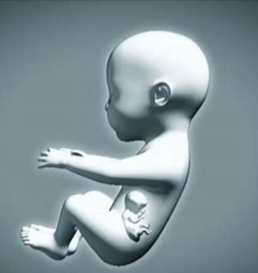 Fetus in fetu