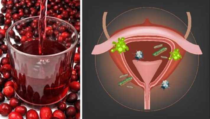 Cranberry ayuda a prevenir infecciones