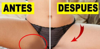 manchas_oscuras_en_los_pies