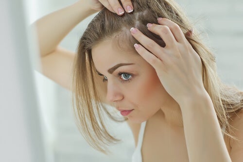 Claros en la cabello causado por la perdida de cabello