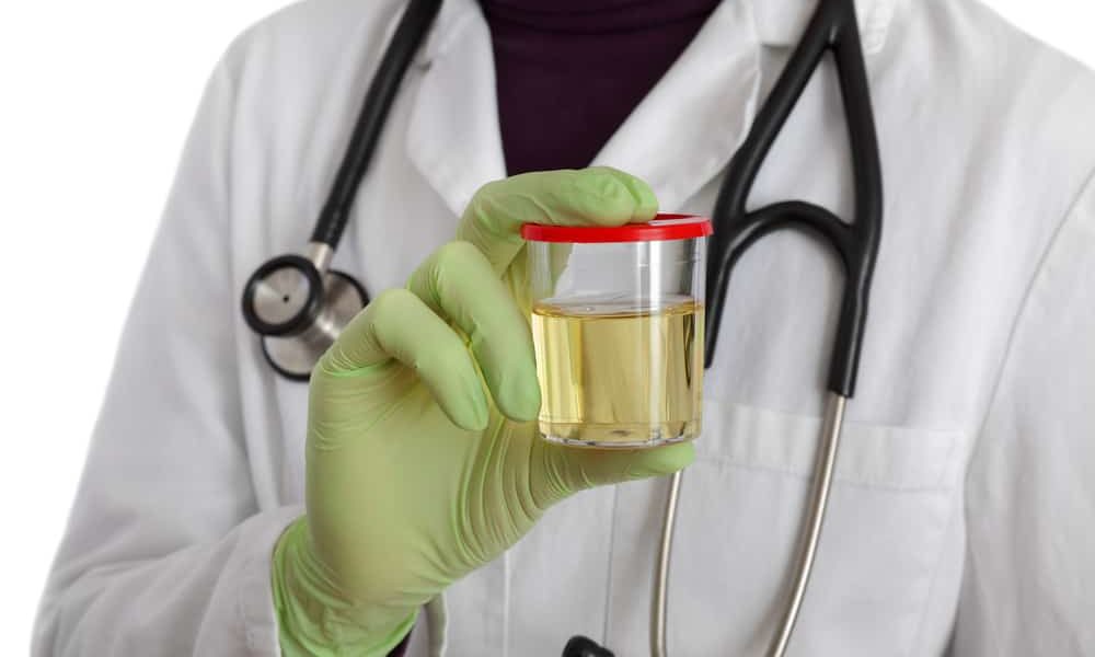 silueta de un médico con un frasco de muestra de orina en la mano. 
