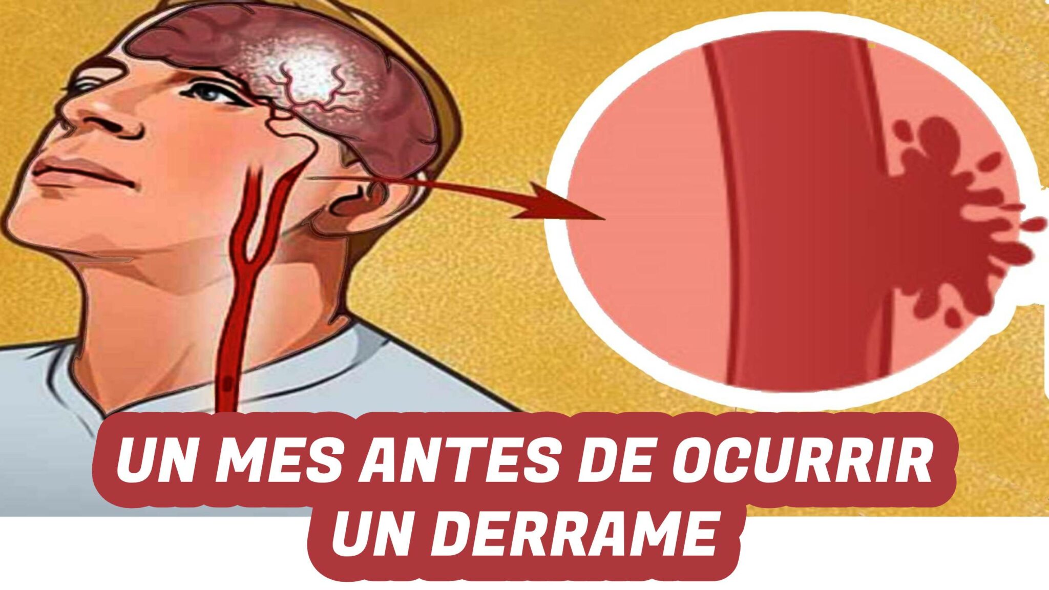Un derrame TE AVISA UN MES ANTES y el 99% de las personas no lo saben ...